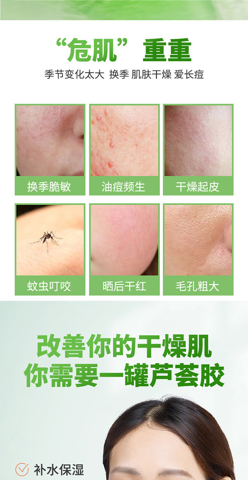 雅公主芦荟胶芦荟凝胶300g晒后修护淡化补水保湿舒缓痘印降红芦荟凝胶膏