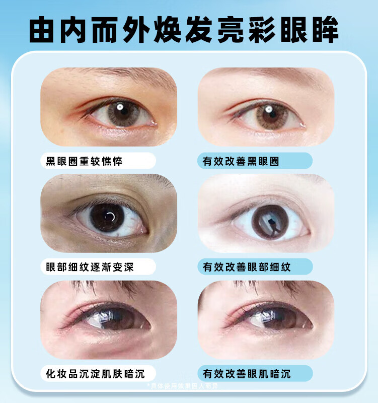 sakose凡士林蛇毒肽紧致抗皱冻干眼膜贴2盒装 淡化黑眼圈眼袋细纹男女士