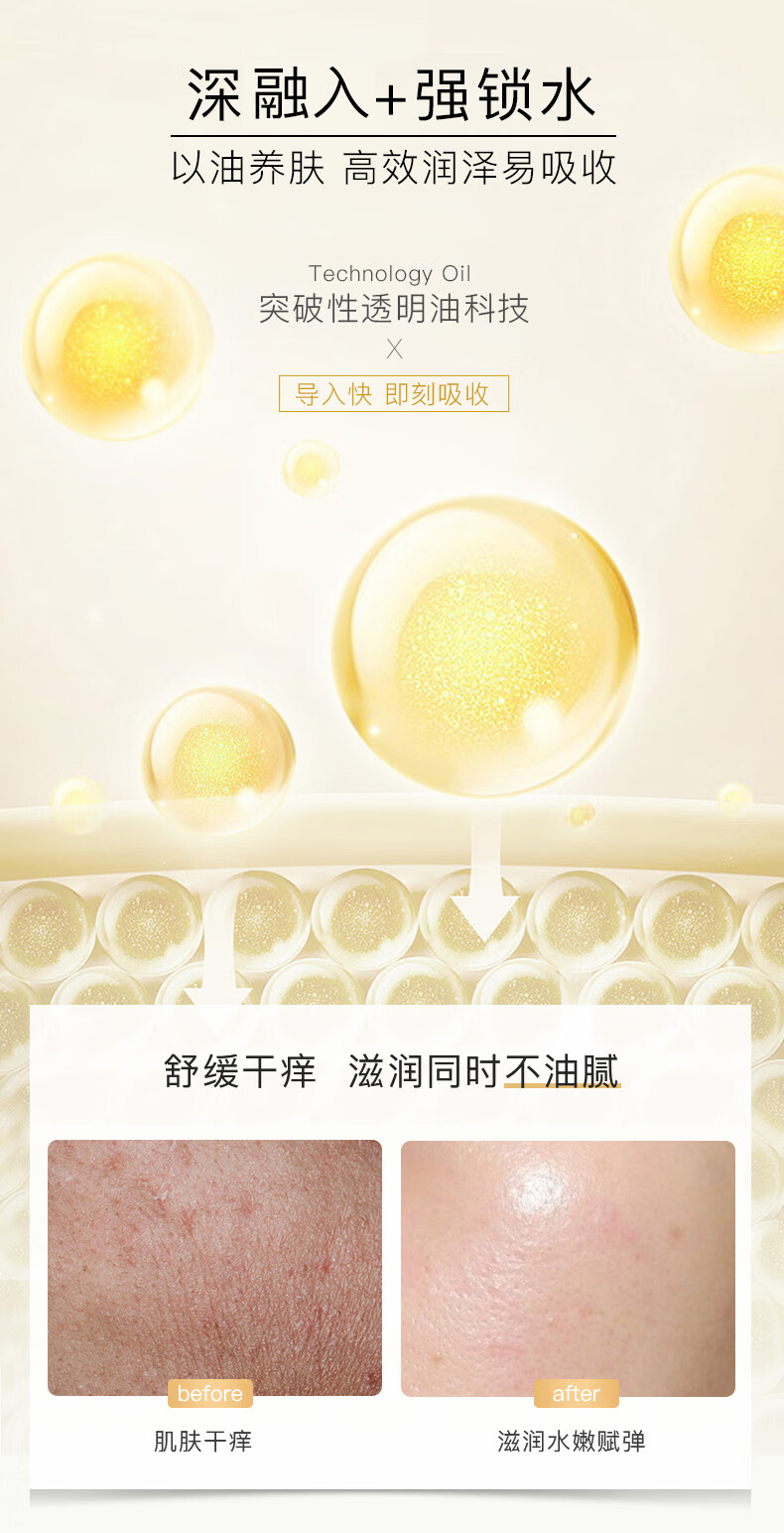 福来（freiol）特护按摩精油妊娠油产前精油按摩紧致精华油润肤油125ml/瓶