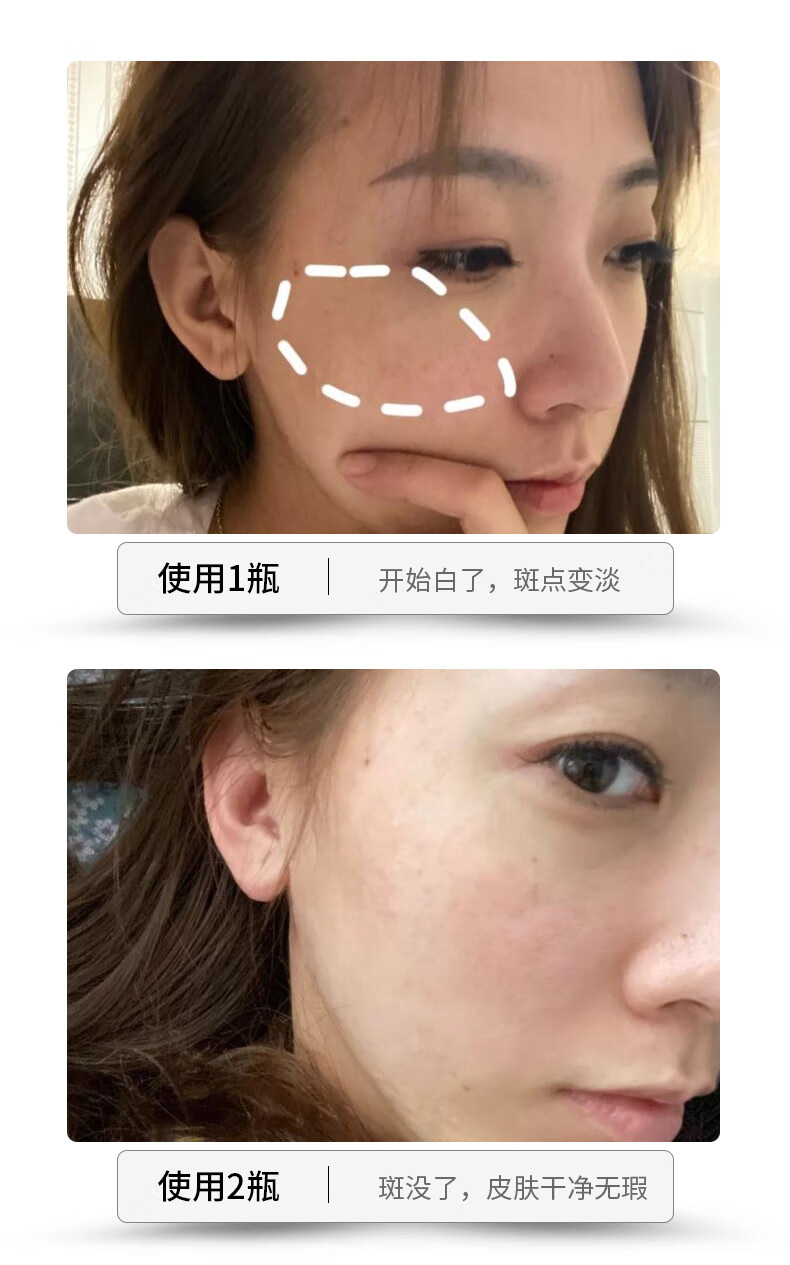 NHFOUYOU美白祛斑睡眠面膜免洗补水淡斑去黄提亮肤色秘方集免洗面膜 1盒【体验装】建议按疗程使用