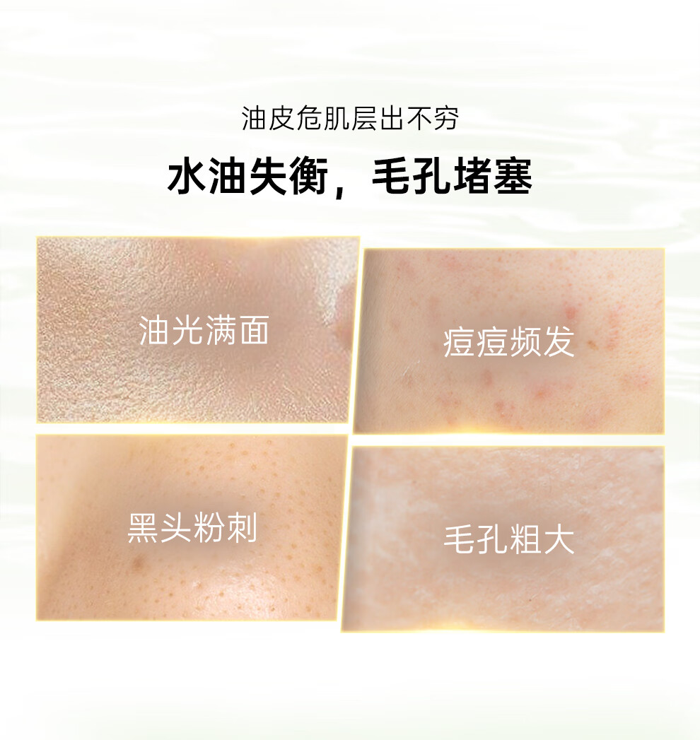 泊美（PURE & MILD）鲜纯珍萃控油净痘控油补水改善痘印护肤套装(爽肤水+乳液)男女士