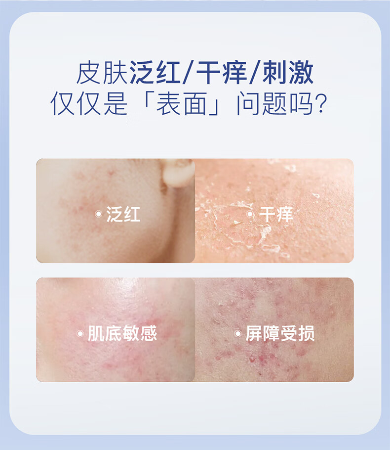 优理氏（UNES）酵母冻干粉多肽修护维稳褪红寡肽复合原液精华液护肤化妆品套装 【维稳褪红】酵母冻干粉20支