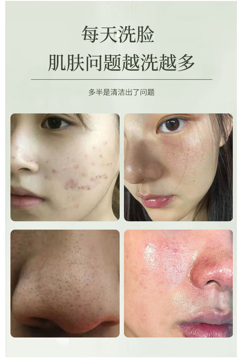 DRAR叶绿素氨基酸洗面奶至清洁黑头本粉刺毛孔细嫩洁面泥男女士学生 1瓶体验装【全场商品贈起泡网】