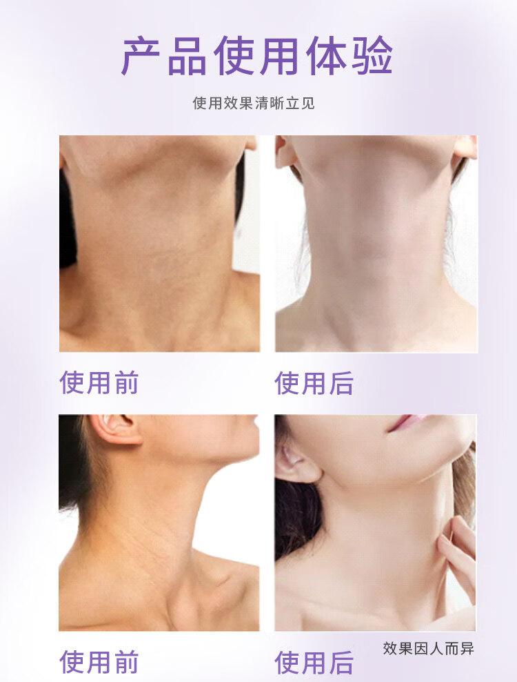 sakose凡士林特润修护柔珠滚轮颈霜2只装共100g 颈膜淡化颈纹提拉紧致颈部按摩精华护理抗皱保湿滋润美颈霜