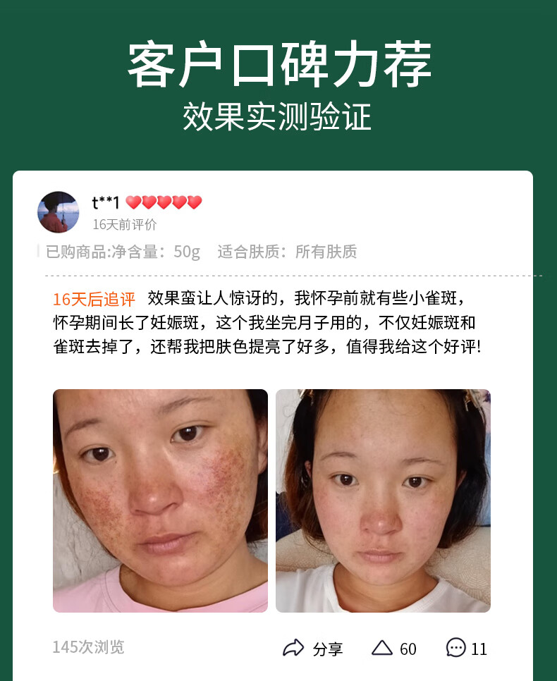 NHFOUYOU美白祛斑睡眠面膜免洗补水淡斑去黄提亮肤色秘方集免洗面膜 1盒【体验装】建议按疗程使用