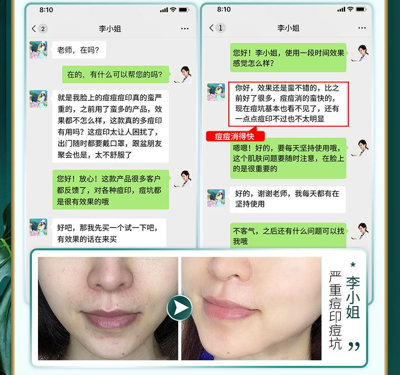 同济堂【南方医科大学】水杨酸洗面奶氨基酸清爽控油抗痘黑头角质温和深层清洁收缩毛孔保湿补水