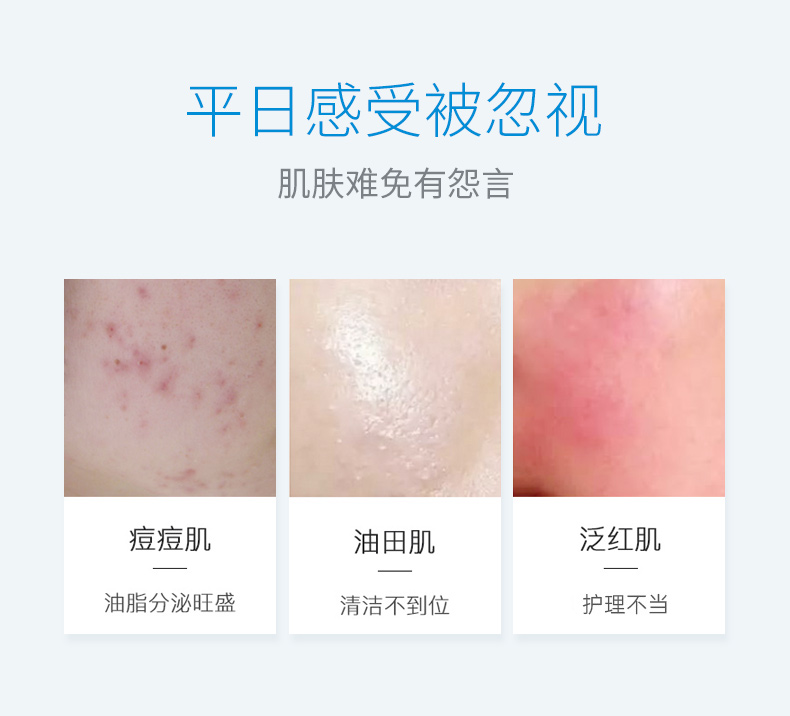 绽妍维生素原b5保湿爽肤水100ml敏感肌控油化妆湿敷水护肤品