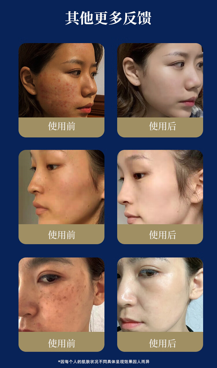 南京同仁堂睡眠面膜美白免洗面膜祛斑补水淡化斑点细致毛孔改善粗糙男女通用120g