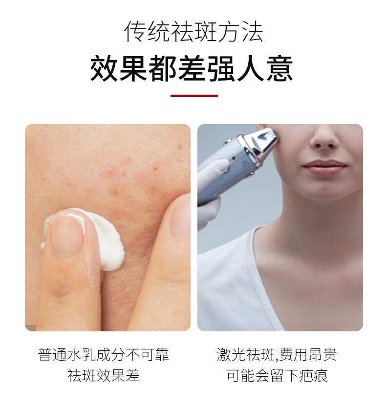 仁康博士美白祛斑霜淡斑去斑淡化黑色素沉淀脸部老年斑20g