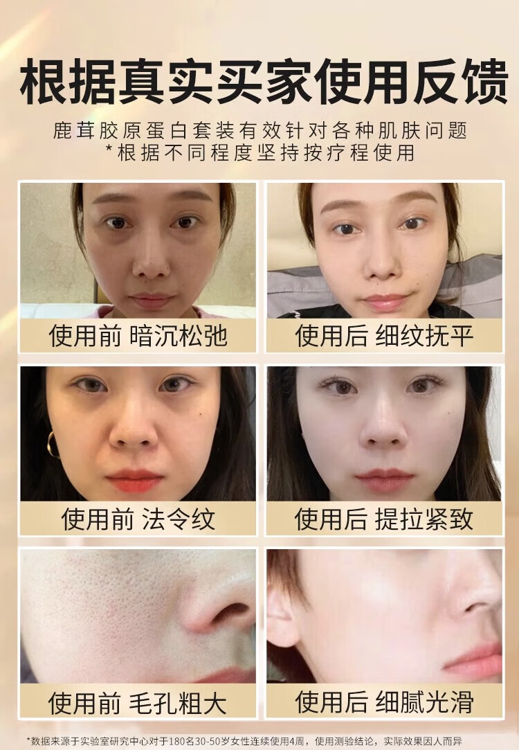BEAUTY NOTES贵妇级后天气滋养丹护肤品套装水乳精华液八件套七夕生日礼物礼盒