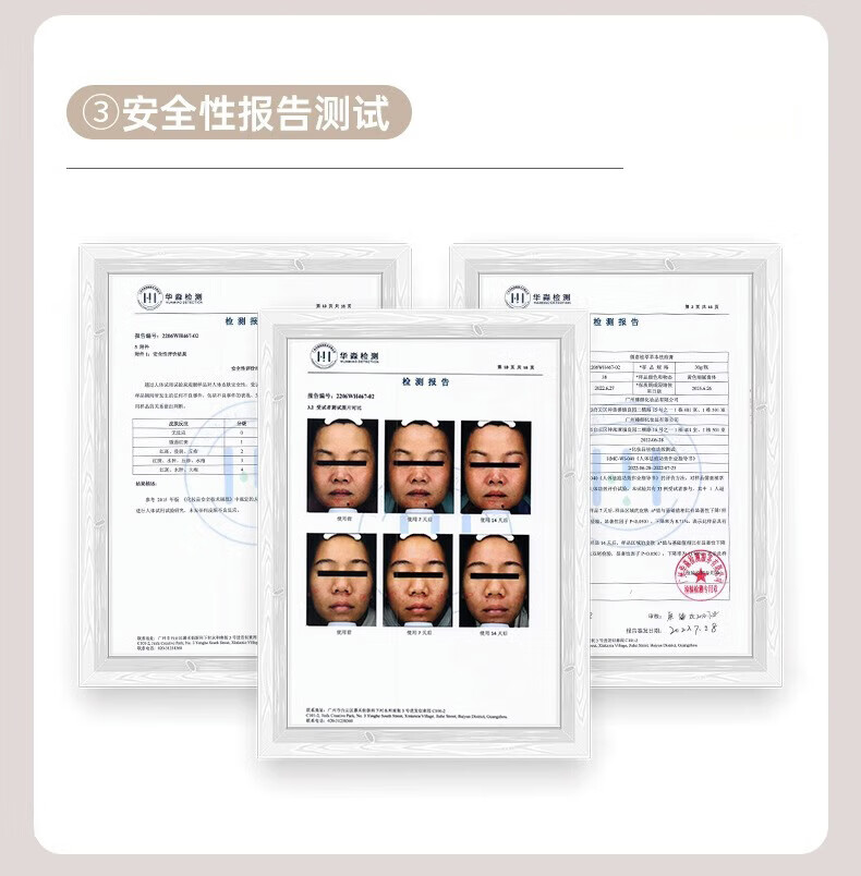 同仁堂祛痘药痘痘膏去痘痘和痘印男女初高中学生粉刺青春痘20g