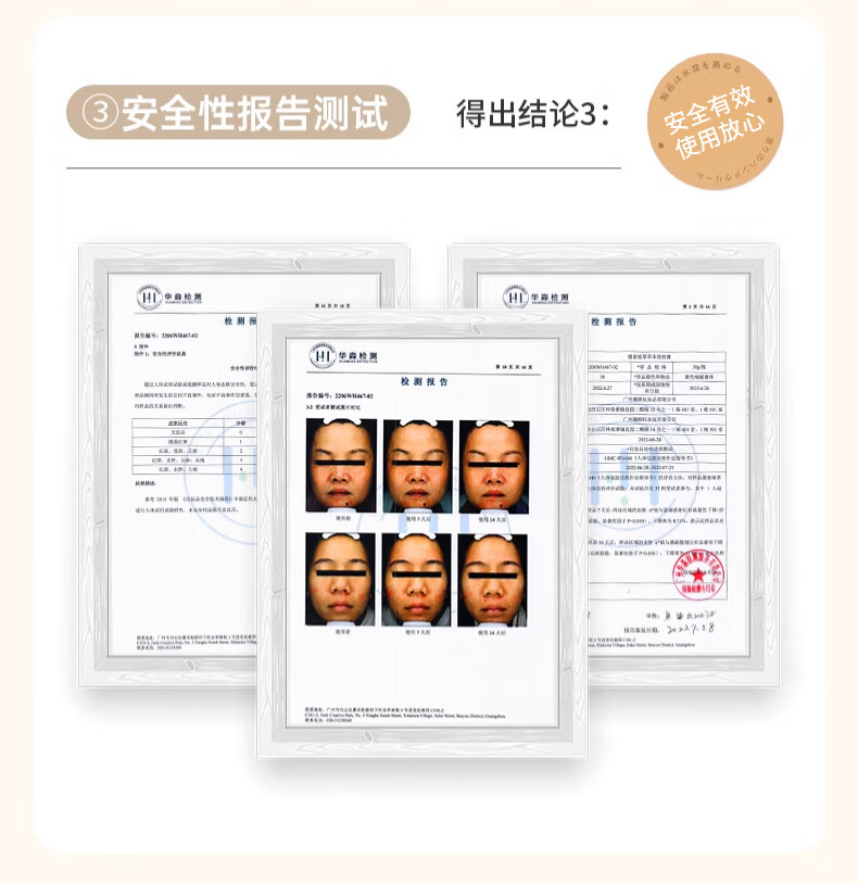 致朵祛痘霜膏修护淡化痘印痘坑去痘痘和痘痘印祛去粉刺青春痘30g/瓶