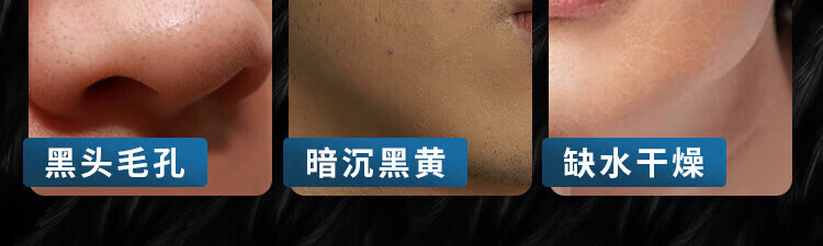 国药精养美白洗面奶氨基酸洁面乳祛斑控油抗痘收缩毛孔保湿清洁男士150ML