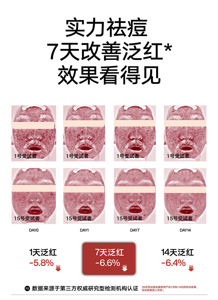 理然男士有效祛痘洁面补水保湿2件套 控油抗痘减少痘痘男士护肤品
