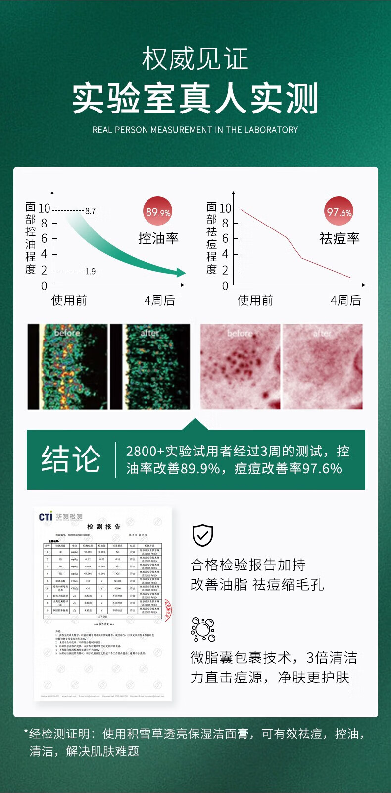 BAINHR积雪草洗面奶控油深层清洁毛孔抗痘氨基酸温和保湿洁面乳300ml