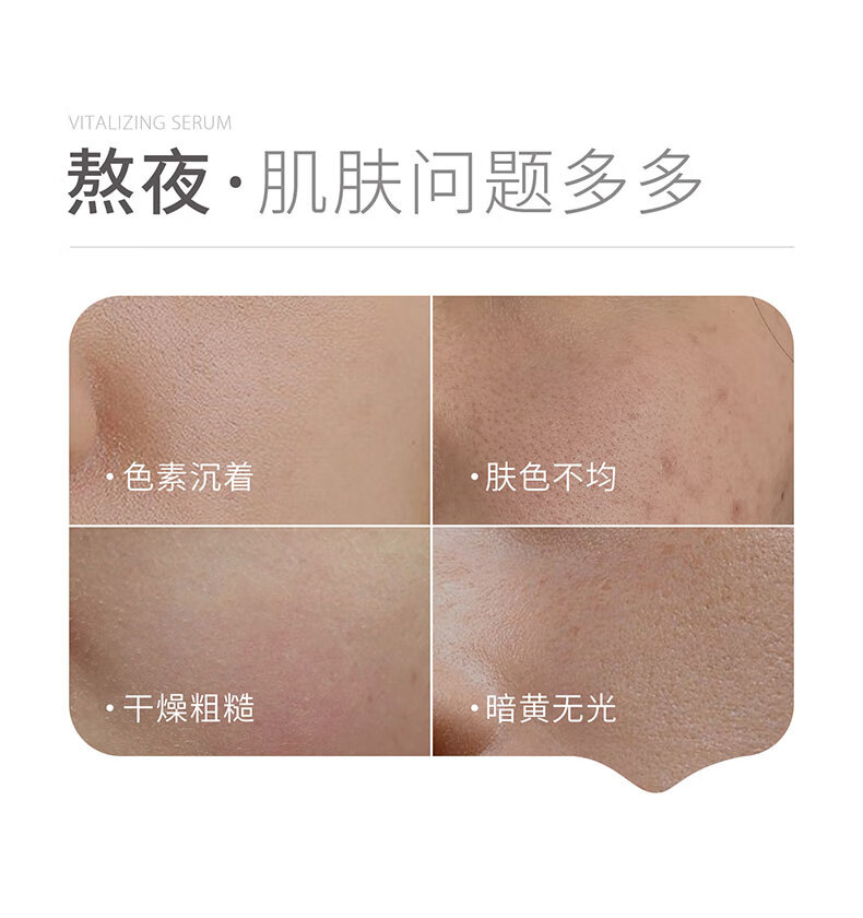 934熬夜唤醒精华露高光精华唤醒熬夜肌肤焕现光彩30g