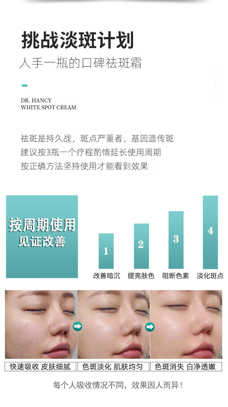 云南本草美白祛斑霜淡化雀斑黄褐斑妊娠斑晒斑老年斑男女通用20g