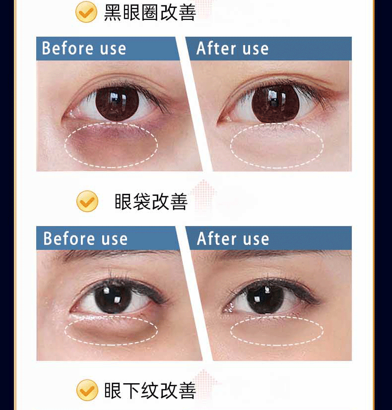 广药白云山 类蛇毒眼霜眼袋黑眼圈淡化细纹脂肪粒鱼尾纹提拉紧致眼纹男士女30g