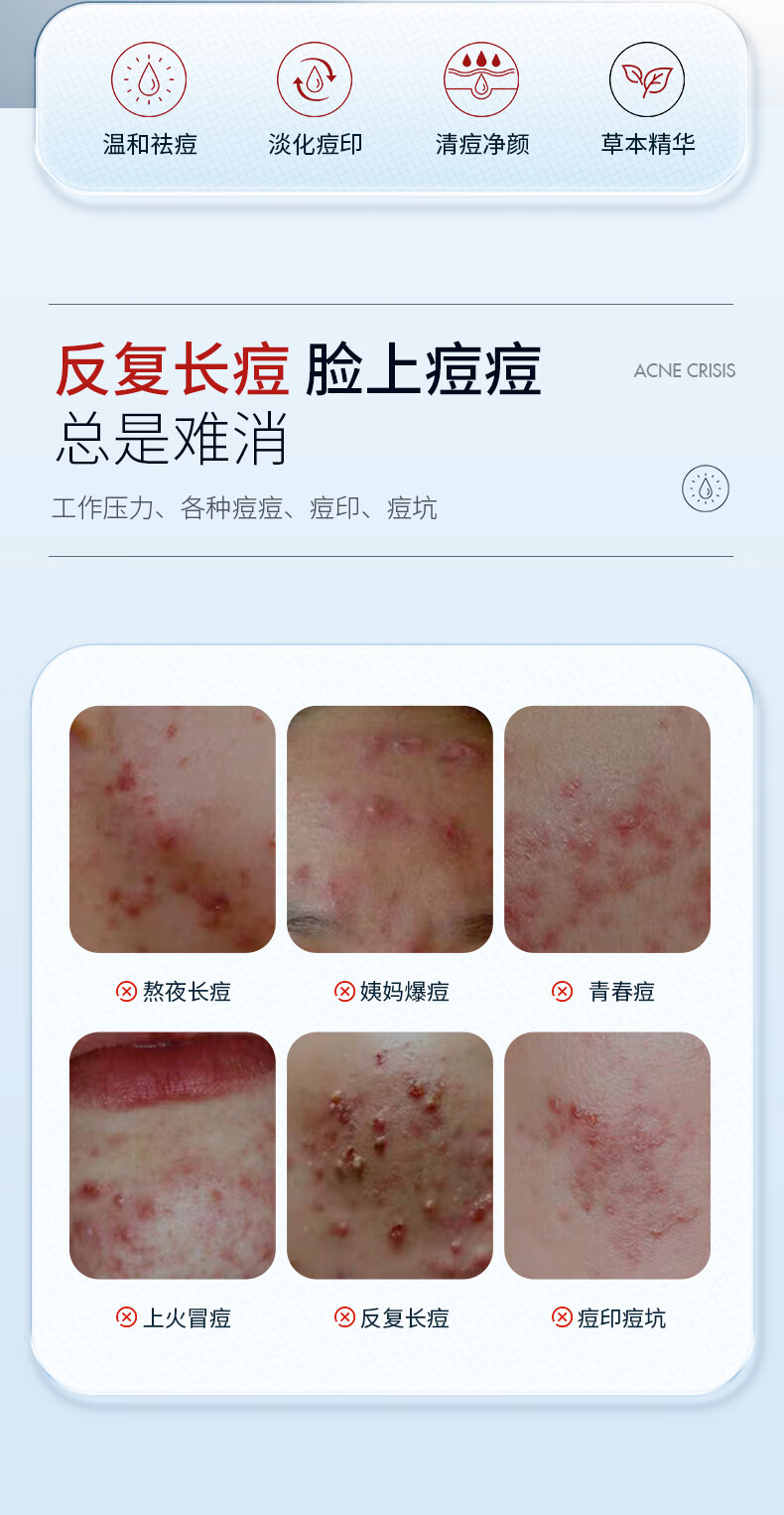 国药精养祛痘膏去痘疤痘坑痘印修护红肿闭口粉刺痘肌净肤青春痘40g
