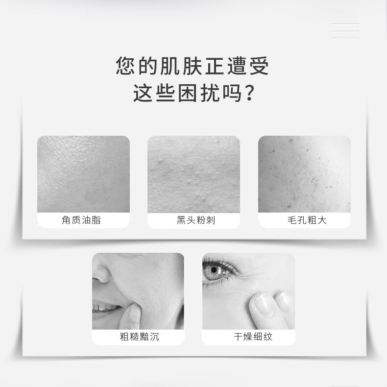 AKF控油清洁净透泥膜涂抹式面膜补水深层清洁角质泥膜100g 控油清洁泥膜