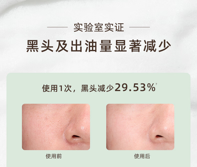 KIMTRUE 且初土豆泥氨基酸洗面奶男女士清洁保湿控油泡沫洁面乳膏150g