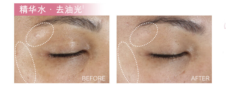 雅诗兰黛鲜活亮采红石榴水乳套装（精华水200ml+倍润乳液100ml）护肤品