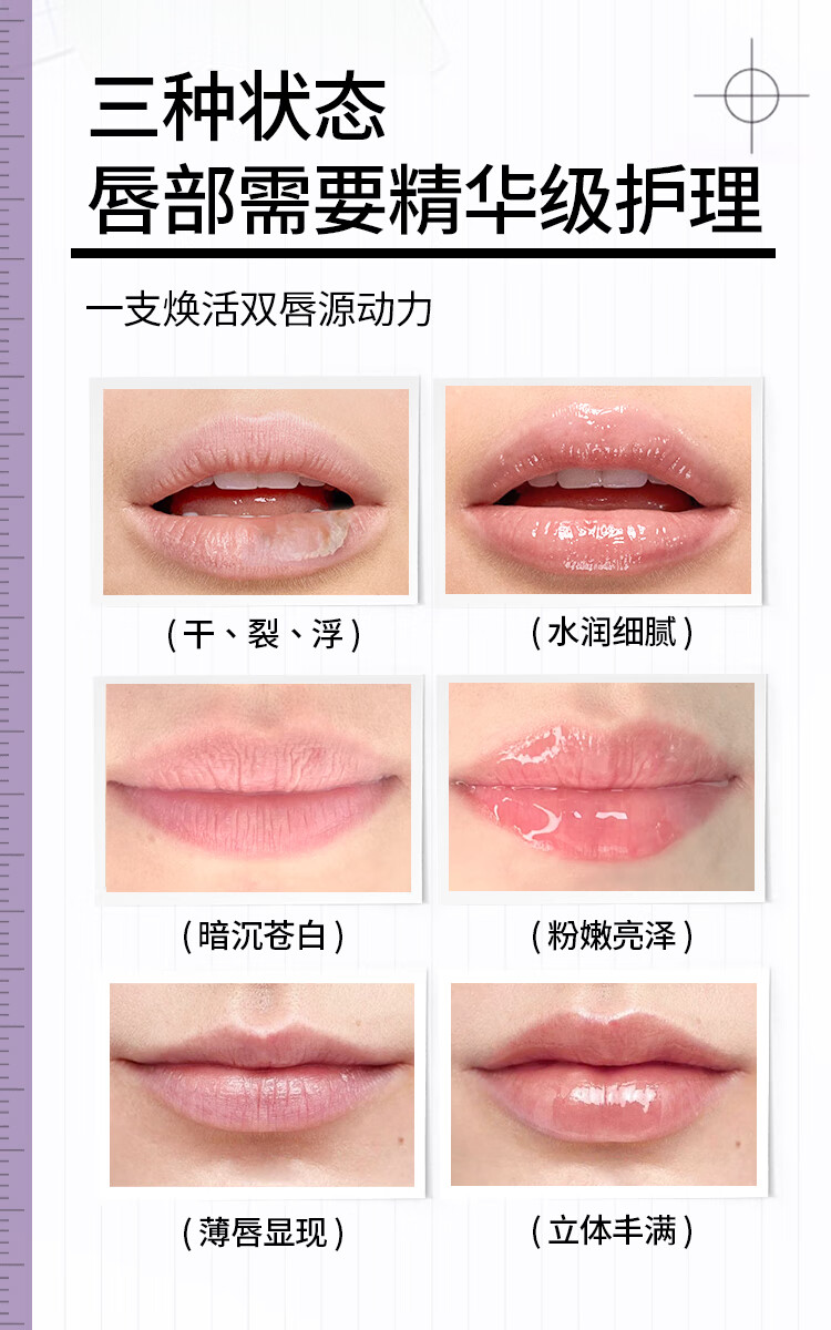 菜鸟和配方师B5胚芽唇部美容精华液 淡化唇纹补水保湿滋润去死皮润唇膏女 5ml（新款升级2.0版）