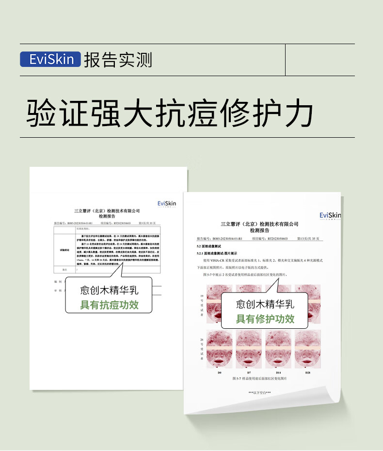 溪木源愈创木抗痘水乳套装（洁水乳）控油补水修护油敏肌护肤品礼物女