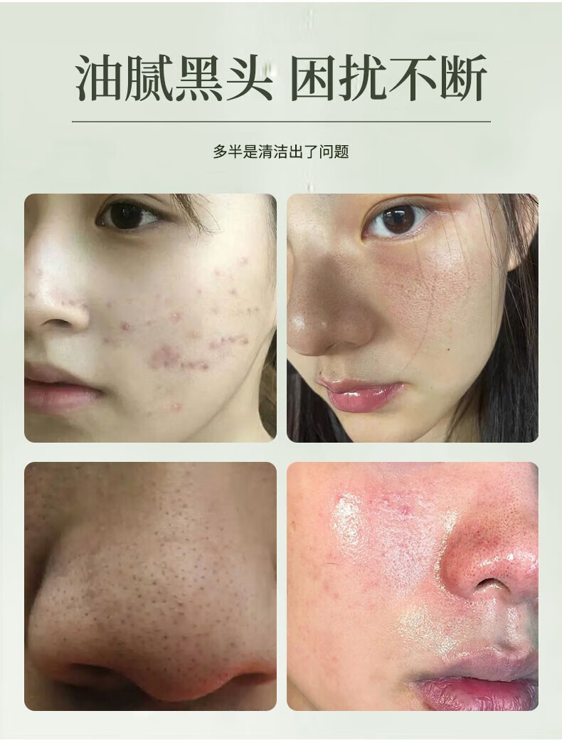 DRAR叶绿素氨基酸洗面奶去清洁黑头粉刺毛孔油皮收缩男女士洁面泥学生 1瓶【体验装】