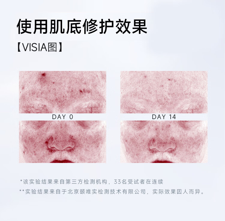 菜鸟和配方师第二代姜黄素祛痘精华液30ml 无酸祛痘护肤品面部精华 敏肌适用