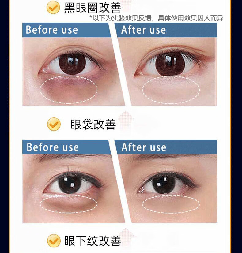 广药白云山类蛇毒肽眼霜淡化细纹脂肪粒抗皱纹提拉紧致眼霜黑眼圈男女士30g