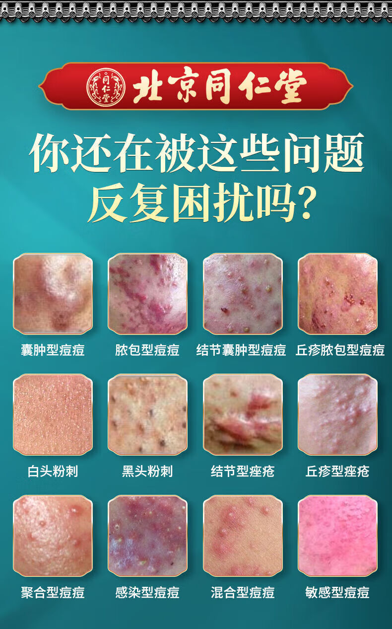 同仁堂草本祛痘膏痘印淡化清痘印痘坑修复和青春痘闭口粉刺男女士20g