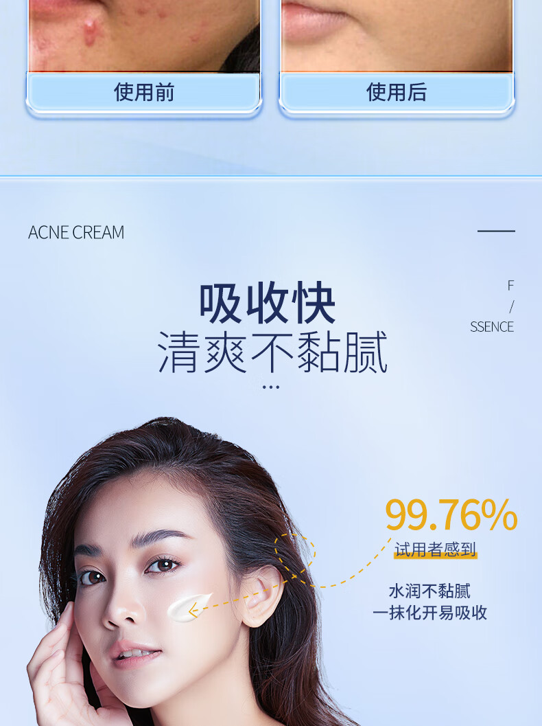 ORGINESE甘草植萃祛痘精华乳膏去闭口粉刺额头红肿痘痘姨妈痘下巴抗痘凝胶