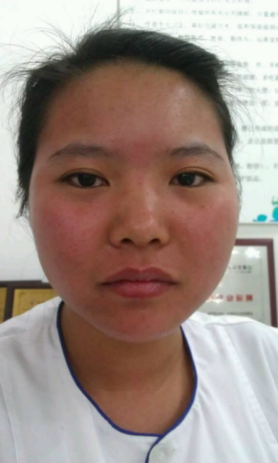 韩医生专业祛痘连锁