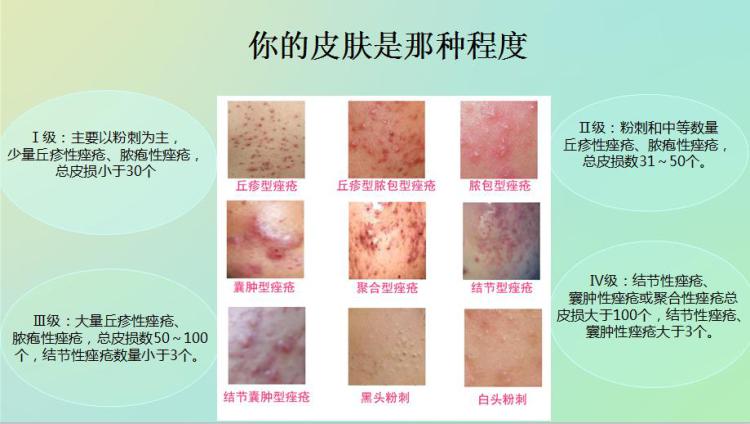 原价338元激素脸体