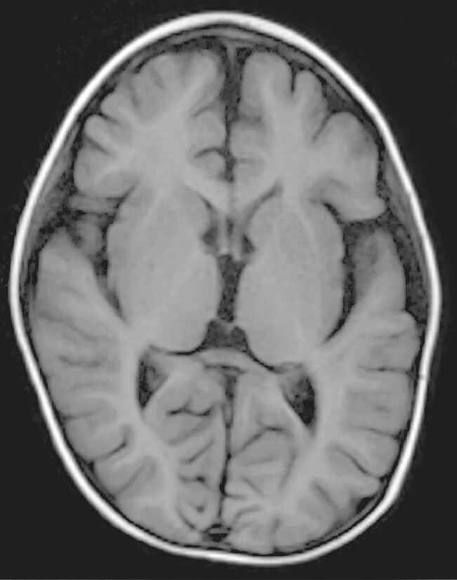 儿科神经系统疾病病例解析pdf/doc/txt格式电子书下载