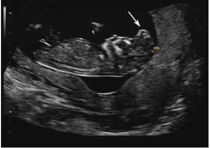胎儿结构发育异常的遗传咨询pdf/doc/txt格式电子书下载