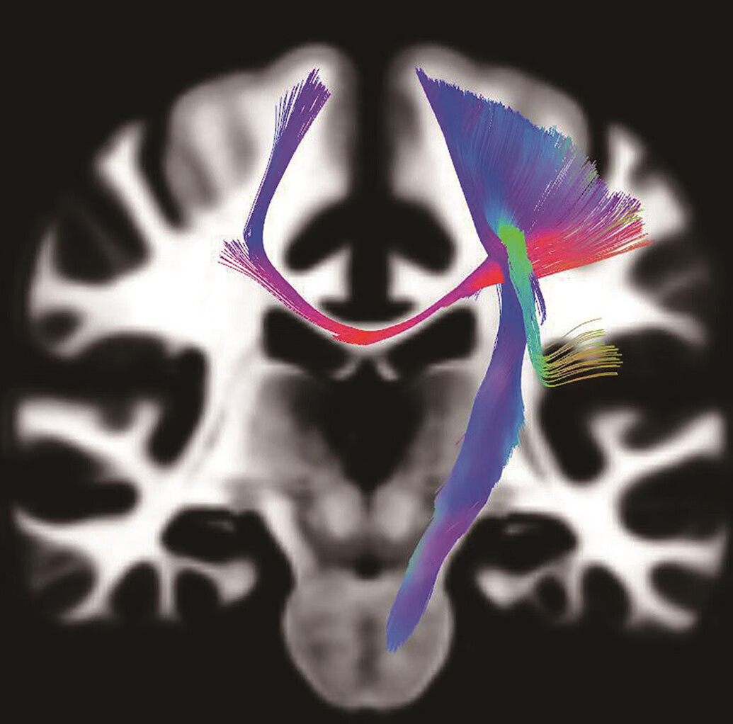颅脑影像诊断学（第3版）pdf/doc/txt格式电子书下载
