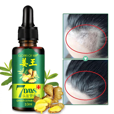 

10ml Damaged Hair Repair Growing Faster for Women&Men Hair Growth Serum Essence Anti Preventing Hair Loss Alopecia Liquid