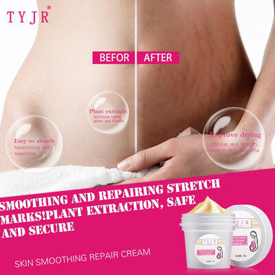 

Pregnancy Repairing Cream Stretch Marks Scar Obesity Maternity Skin Body Removal Repair Cream 35g
