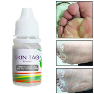 

10ML Body Warts Treatment Cream Skin Tag Remover Foot Corn Removal Plantar Genital Warts Ointment Foot Care Cream
