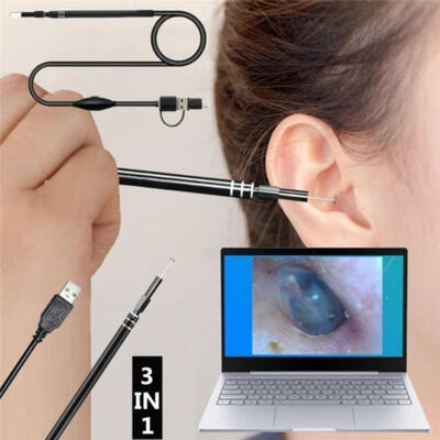 

3in1 Ear Cleaning Endoscope USB 55mm Visual Earpick HD Camera Spoon Otoscope