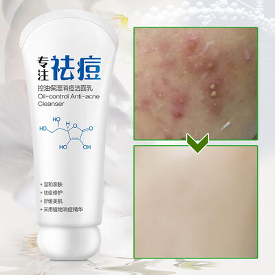 

Oil control moisturizing acne cleanser Acne Treatment Facial Cleanser Black Head Remove Oil-control Deep Cleansing