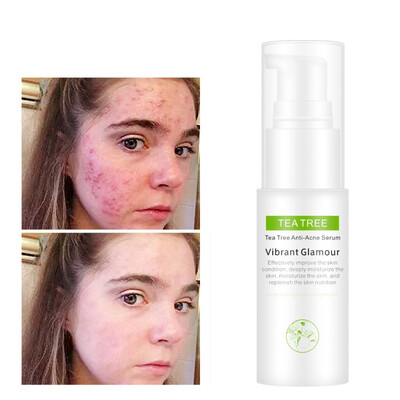 

Tea Tree Anti-Acne Serum Acne Scar Acne Treatment Acne To Print Anti-wrinkle Essence Oil-control Shrink Pores