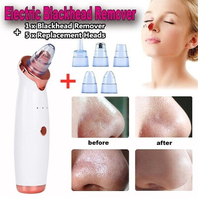 

2019 Newest Professional Blackhead Vacuum Acne Cleaner Pore Remover Electric Skin Facial Cleanser Kit