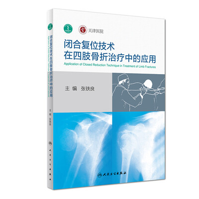 

闭合复位技术在四肢骨折治疗中的应用