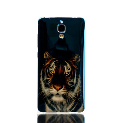 

MOONCASE Plating Blue Cool Design Soft TPU Case Cover For Xiaomi Mi 4