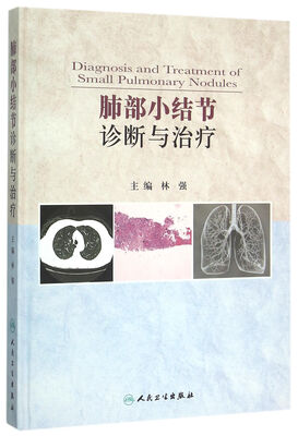 

肺部小结节诊断与治疗