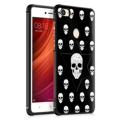 

Goowiiz Fashion Phone Case For Xiaomi Redmi 5ANote 5ANote 5A Prime Luxury 3D Cute Cartoon Slim Full Soft Silicone