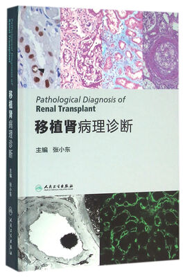 

移植肾病理诊断手册